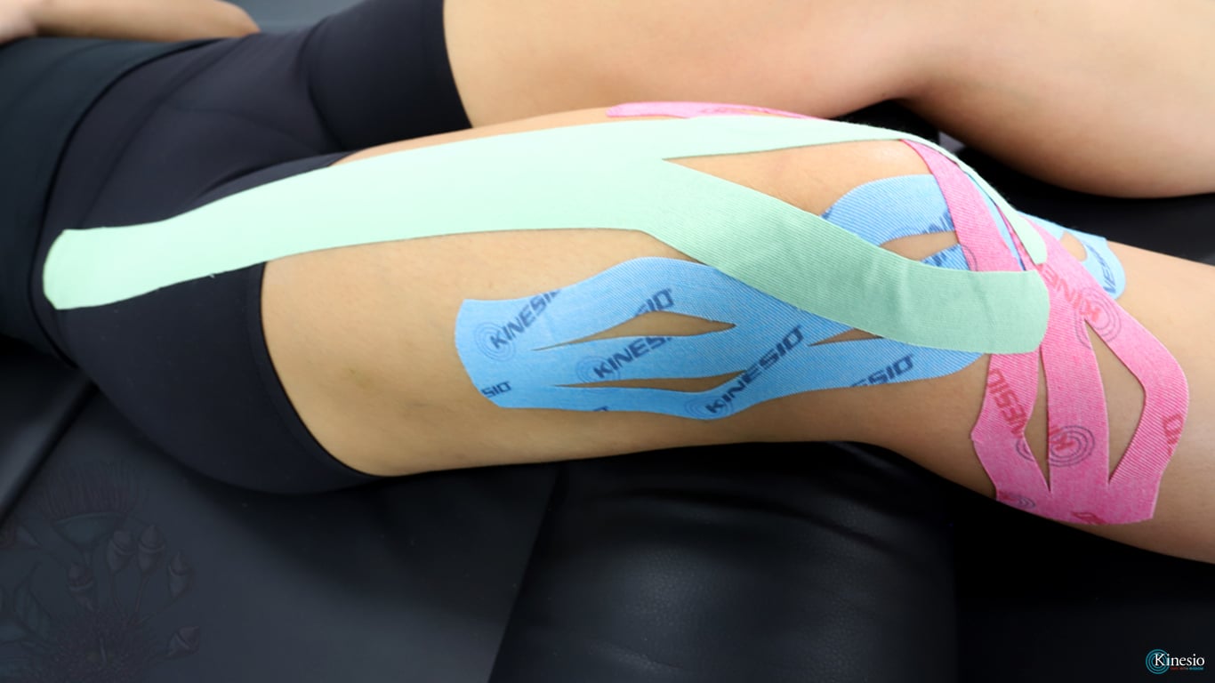 Knee Pain - Kinesio Tape