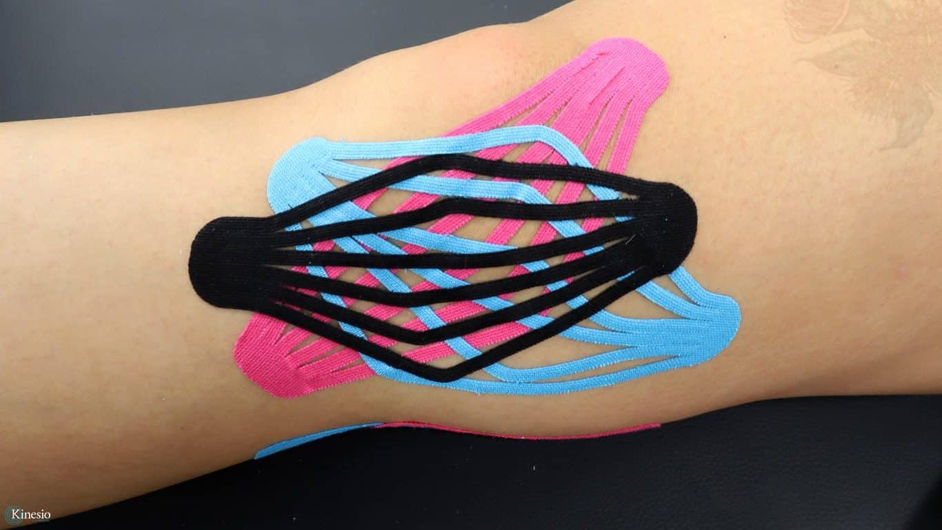 Kinesio-Tape-EDF-Knee-Side-Landscape - Kinesio