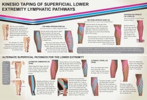 Kinesio Taping Of Superficial Lower Extremity Lymphatic Pathways - Kinesio