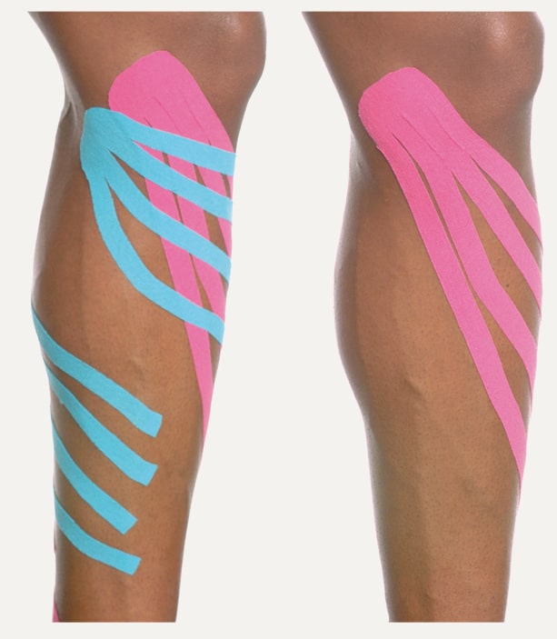 Kinesio Taping Of Superficial Lower Extremity Lymphatic Pathways - Kinesio