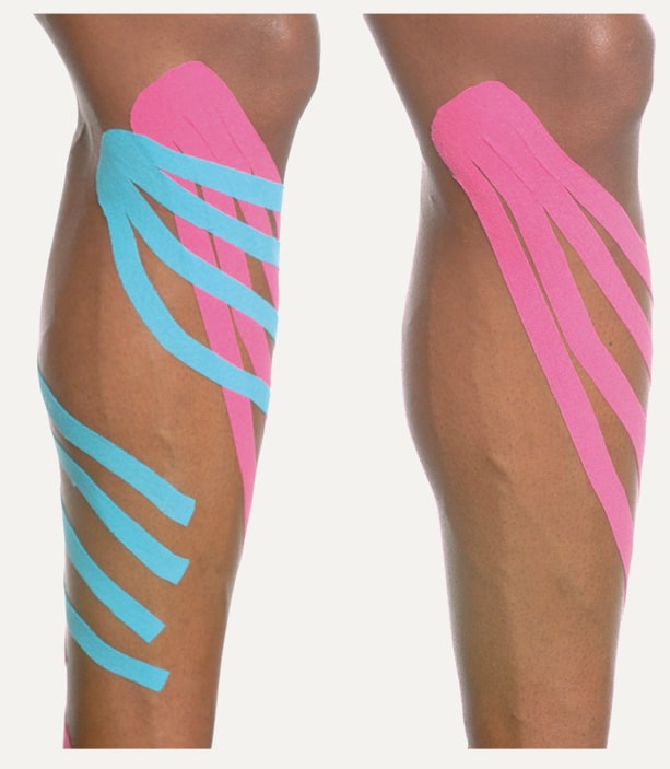 Kinesio Taping Of Superficial Lower Extremity Lymphatic Pathways Kinesio