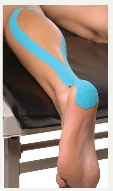 Kinesio Taping Of Superficial Lower Extremity Lymphatic Pathways