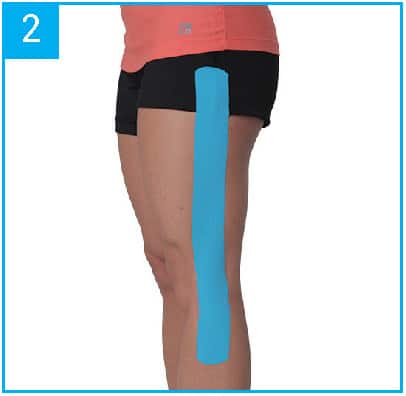 KT Tape Tutorial - IT Band  The IT Band, or iliotibial band, is a