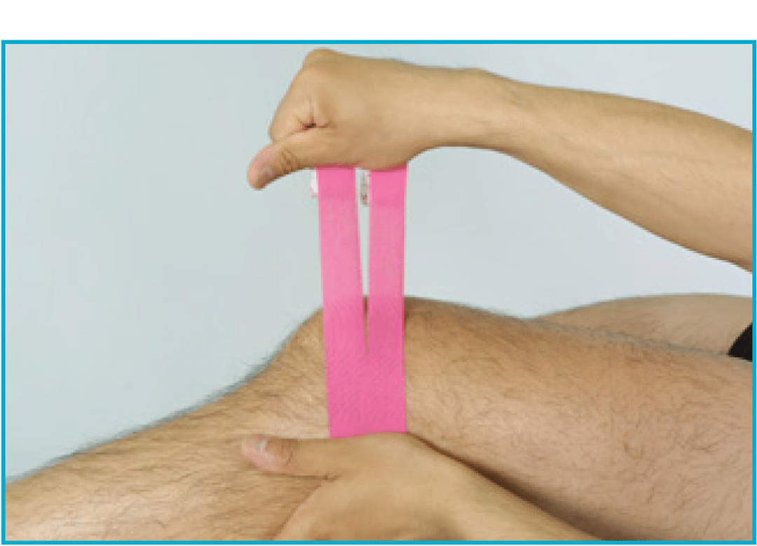 How to Correct Patellar Tracking Problem With Kinesiotape - 8 of