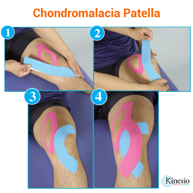 Kinesio Taping the World for Health