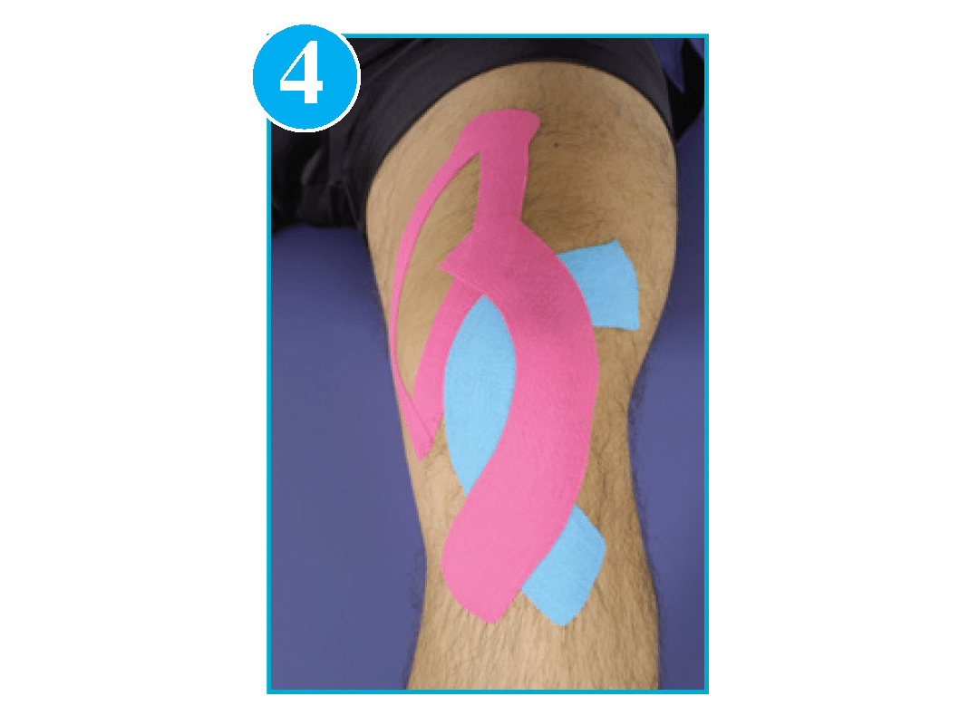 Patella Star - Kinesio Medical Taping for the Mature Adult - Kinesio Tape