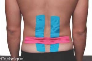 Kinesio H Techinque Back Taping