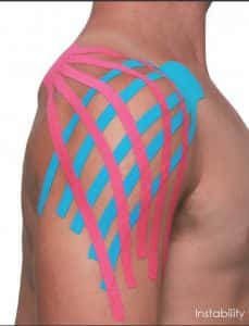 Kinesio Lymphatic Shoulder Taping