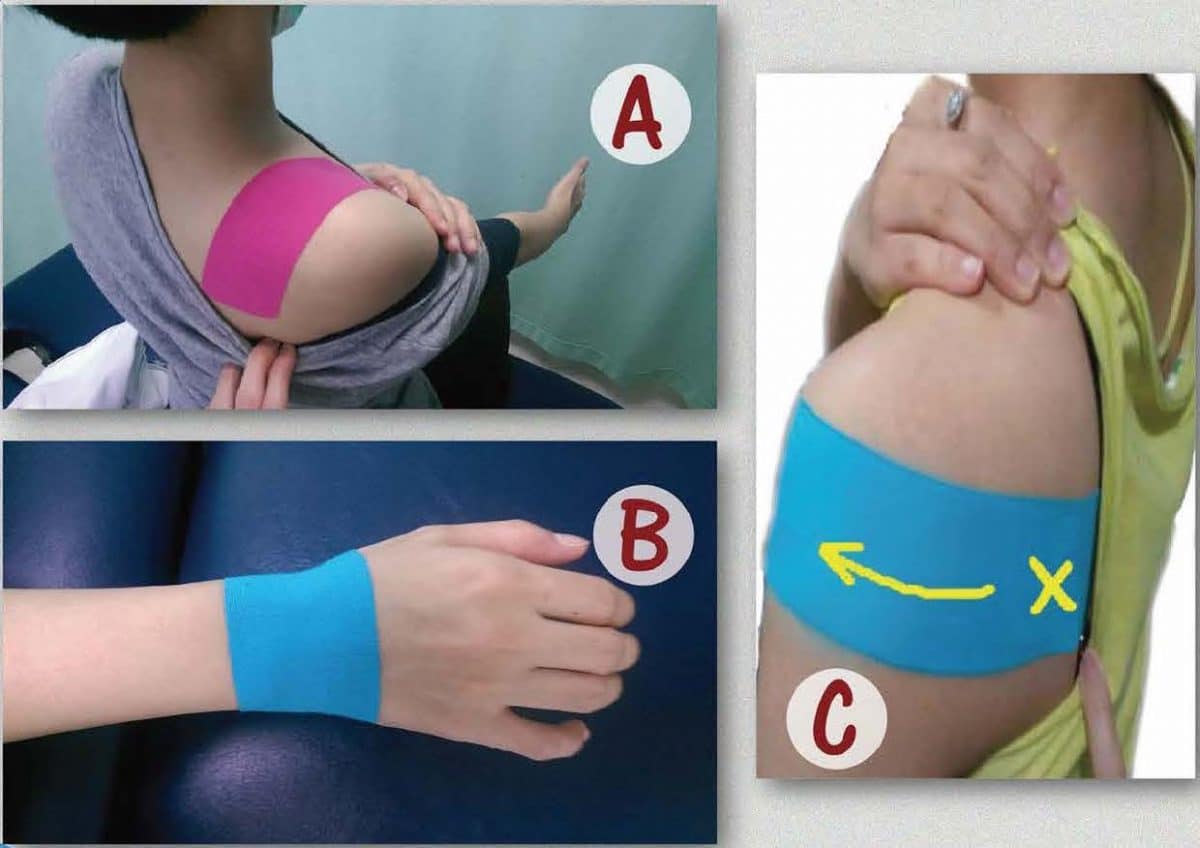 Taping for the Shoulder, A, Wrist Taping B, Side Arm Taping C